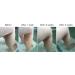 G16 Skin Repair Lotion: Effective Ichthyosis Treatment Cream for Outstanding Results in 2 Weeks - Buy Online on GoSupps.com
