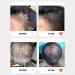 Hair Revitalizer - Ayurvedic Hair Growth Remedy | Fall Protection Nourishment & Moisturization | 10 Potent Oils | All Hair Types - 1 Fl. Oz - Buy Online on GoSupps.com