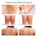 Lupure Dark Spot Corrector Cream - Professional Formula for Dark Spot Removal on Armpit, Neck, Knees, Elbows, Private Areas - Natural Brightening Treatment - 80ml - Buy Online on GoSupps.com