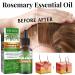 Rosemary Hair Growth Essential Oil - 30ml | Hair Loss Care Scalp Nourishment & Regrowth Serum for Men & Women | 3 Pcs for Dry Damaged Hair - Buy Online on GoSupps.com