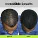ECLIPSE Hair Fibers for Thinning Hair (BLACK) 100% Undetectable Natural Fibers - 15g Bottle - Completely Conceals Hair Loss in 15 Seconds - For Women & Men - Buy Online on GoSupps.com