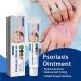 FRTG Dermatitis and eczema cream itching and irritated skin suitable for dry skin eczema and psoriasis caring cream for dry and sensitive skin 1 - Buy Online on GoSupps.com