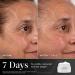Medik8 Advanced Pro Collagen Peptide Cream - Daily Face Moisturizer for Dry Skin - Lifting Moisturizer Face Cream with Anti-Aging Peptides - 1.6 oz - Buy Online on GoSupps.com