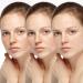 Extreme Dark Spot Corrector 30mL | Fast-Acting Skin Treatment for All Skin Types - International Shipping - Buy Online on GoSupps.com