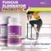 Fungus Eliminator Probiotic: Natural Nail Health Support Formula - Buy Online on GoSupps.com