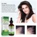 Rosemary Hair Growth Oil | Hair Loss Treatment | Stimulates Growth, Strengthens & Nourishes Scalp | For Men & Women | 2.02 Oz - Buy Online on GoSupps.com
