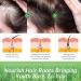 ELBBUB Rosemary Oil for Hair Growth - Undiluted Rosemary Oil for Hair Skin - Cleansing Rosemary Essential Oil for Dry Scalp Care Rid of Itchy and Dry Scalp 1 120.0 millilitre - Buy Online on GoSupps.com