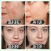 Blackhead Remover for Face & Nose - Deep Cleansing Pore Treatment for All Skin Types | Acne Solution for Men & Women - Buy Online on GoSupps.com