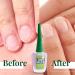 I On Nails: Ultimate Nail Strengthener & Growth Treatment - Clear Hardener & Keratin Repair for Damaged Nails - Buy Online on GoSupps.com
