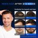 Intensive Hair Regrowth Treatment - 5% Active Complex | Natural Organic Formula for All Hair Types | 2 Fl OZ | Stop Hair Loss for Women & Men - Buy Online on GoSupps.com