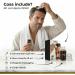 Derma roller cheveux produit pour la perte de cheveux renforce et stimule - Buy Online on GoSupps.com