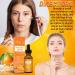 1oz Vitamin C Serum for Glowing, Youthful Skin - Anti Aging Spot Corrector & Antioxidant Beauty Oil - Buy Online on GoSupps.com