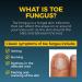 Fungi-Nail Pen Applicator Anti-Fungal Solution | Kills Nail & Athlete's Foot Fungus | Clinically Proven | 0.20 Fl Oz (Pack of 2) - Buy Online on GoSupps.com