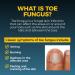 Maximum Strength Fungi Nail Anti Fungal Treatment 1.7mL - Toe and Foot Care - Buy Online on GoSupps.com