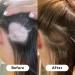 HAIR BURST Biotin Hair Gummies for Longer & Thicker Hair - Zinc, Vitamin C & Selenium - 1 Month Supply (60 Gummies) - Buy Online on GoSupps.com