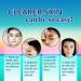 Star Pimple Patches | Cute Acne Patches with Salicylic Acid Tea Tree & Calendula Oil | Teen Acne Treatment for Girls - International Shipping Available - Buy Online on GoSupps.com