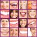 Purple Teeth Whitening Toothpaste - Stain Remover & Color Corrector for Yellow Teeth - Buy Online on GoSupps.com