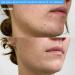 PMD Clean Acne - Smart Facial Cleansing Device with Silicone Brush & Acne-Fighting Blue Light Therapy Treatment - Waterproof - SonicGlow Vibration Technology - Clear Pores Blackheads and Acne - Buy Online on GoSupps.com