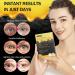 Under Eye Patches (14 Pairs) - Skincare for Dark Circles & Puffiness | Dry Eyes Eye Mask for Adults - Buy Online on GoSupps.com