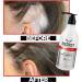 Redist Anti Hair Loss Shampoo 500ml | Strengthens Hair Roots, Nourishes & Moisturizes | For Men & Women | Promotes Healthy, Shiny Hair - Buy Online on GoSupps.com