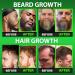 Beard Growth Kit w/Grow XXL Beard Oil/Facial Hair Serum for Men + 14-in-1 BIOTIN Gummies/Hair Growth Vitamins for Men + 6X Liquid Biotin with Collagen Peptides - Formulated in America - Buy Online on GoSupps.com
