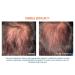 Ducray Neoptide Men Hair Lotion - 0.32 lb | Promotes Hair Growth & Thickness - Buy Online on GoSupps.com