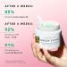 Farmacy Green Clean Makeup Meltaway Cleansing Balm 100ml - Echinacea Infused - 3.4 Fl Oz - Buy Online on GoSupps.com