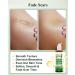 5 Floz Vitamin E Oil For Skin Scars Pure Organic Nail Oil vit e for Cuticle Face Body and Hair Nourish Dry Skin Maintain Youthful Antioxidant Fade Scars LIGHTWEIGHT - 150ml 5 Fl Oz (Pack of 1) - Buy Online on GoSupps.com