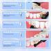 Rechargeable Tooth Polisher | Electric Teeth Cleaning Kit with LED Light | Whitening & Polishing Tools | 5 Brush Heads 4 Speed Modes IPX6 Waterproof - Buy Online on GoSupps.com