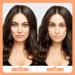 188pcs Ensemble de Lifting Visage Strip Comprend 4 Longueurs Cordes Invisibles et Lifting Visage Immediat Patch en Forme Cylindre et Larme pour Femme Peau Affaiss e - Buy Online on GoSupps.com