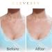 Cleverfy Silicone Chest Wrinkle Pads - 4 Pack T-Shape Anti Wrinkle Decollete Pads - Buy Online on GoSupps.com