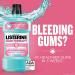 Listerine Gum Therapy Antiplaque Mouthwash - Glacier Mint ADA Accepted - 1L (Pack of 6) - Buy Online on GoSupps.com