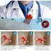 Buy Iokheira Tick Pliers for Dogs & Cats - 3 Set Tick Hooks & Tweezers for Children & Pets | Safe & Simple Tick Remover - Buy Online on GoSupps.com