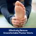 Compound W Maximum Strength Plantar Wart Remover Foot Pads - 20 Count - Buy Online on GoSupps.com