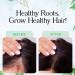 Natural Herbal Hair Growth Oil with Castor Oil for Thick, Healthy Hair - 4 oz - Buy Online on GoSupps.com