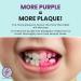 Fresh Knight Plaque Disclosing Tablets - 96 Count, Dental Tablets for Kids & Adults, Shows Plaque, Promotes Healthy Teeth Brushing Habits - Pack of 1 - Buy Online on GoSupps.com