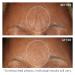 StriVectin Anti-Wrinkle SD Advanced Plus - Intensive Moisturizing Concentrate for Wrinkles & Stretch Marks, 2 Fl Oz - Buy Online on GoSupps.com