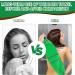 WLLHYF Exfoliating Back Scrubber - Double-Sided Exfoliator Washcloth Towel for Men and Women - Skin Care Body Scrubber - Buy Online on GoSupps.com