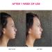 FOREO BEAR Microcurrent Facial Device - Face Sculpting Tool for Instant Face Lift and Firming - Non-Invasive Chin Lift - Fuchsia - Buy Online on GoSupps.com
