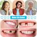 TrelaCo 16 Pcs Dentures DIY Repair Kit - Customizable Fake Teeth Solution for Easy Missing Teeth Repair & Smile Improvement - Buy Online on GoSupps.com
