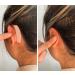 Earo Cosmetic Ear Corrector | Protruding Ear Solution | 20 Patches | Non-Surgical Alternative to Otoplasty | Say Goodbye to Big Ears - Buy Online on GoSupps.com