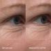 Alpyn PlantGenius Line-Filling Eye Balm - Reduce Fine Lines Puffiness & Dark Circles | 0.5 oz / 14 ml - International Shipping Available - Buy Online on GoSupps.com
