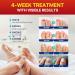 Nail Fungus Treatment For Toenails: Nail Fungus Patches For Altheles Runners Dancers Hikers 32 Patches - Buy Online on GoSupps.com