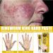 Inalsion Revitaskin Eczema Cure Cream - Eczema & Psoriasis Treatment Relief for Adults (3pcs) - Buy Online on GoSupps.com