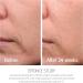 Epionce Renewal Lite Facial Lotion oily skin 1.7 Fl Oz - Buy Online on GoSupps.com