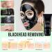 Black Head Remover | Peel Off Charcoal Mask for Deep Cleansing Pores | Acne Treatment for Men & Women - Buy Online on GoSupps.com