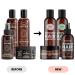 Moerie Ultimate Hair Growth Care Mega Pack - Shampoo, Conditioner, Hair Mask & Spray for Longer, Thicker Hair - Volumizing & Paraben/Silicone Free - 4 Item Set - Buy Online on GoSupps.com