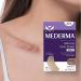 Mederma Medical Grade Silicone Scar Sheet 1.4x3 inches (4 Count) - For Injury, Burn, and Surgery Scars - Buy Online on GoSupps.com