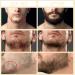 Beard Growth Kit for Men - Beard Roller, Growth Oil, Balm, Comb, Scissors - Birthday Father's Gift - Buy Online on GoSupps.com