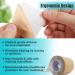 Silicone Scar Tape - Medical Grade Silicon Sheets for Hypertrophic and Keloidal Scars Treatment - Skin Color - Buy Online on GoSupps.com